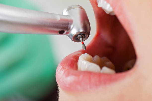 Best Emergency Dental Care for Broken or Chipped Teeth in Jackson, WI